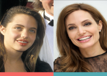 Ana Montana: Stunning Before and After Surgery Transformation