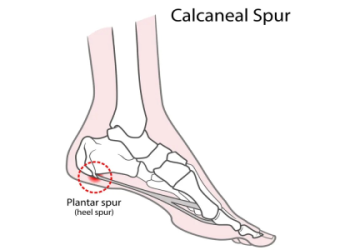 Ankle Bone Pain? Check Out the Latest NYT Coverage.