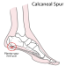 Ankle Bone Pain? Check Out the Latest NYT Coverage.