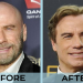 Thinking of a Hair Transplant? See Connor McGregors Possible Results!