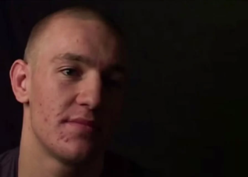How successful was the Conor McGregor hair transplant? Analyzing the results and his much fuller looking hair now.