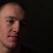 How successful was the Conor McGregor hair transplant? Analyzing the results and his much fuller looking hair now.